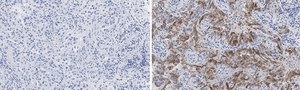 Anti-Integrin &#945;V&#946;8 Antibody, clone EM13309 , ZooMAb&#174; Rabbit Monoclonal recombinant, expressed in HEK 293 cells