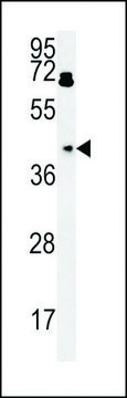 ANTI-BDHA1 (CENTER) antibody produced in rabbit affinity isolated antibody, buffered aqueous solution