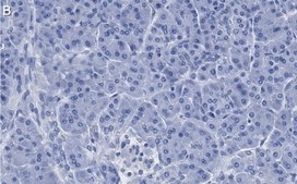 Anti-ISL-1 Antibody, clone 1B11 ZooMAb&#174; Rabbit Monoclonal recombinant, expressed in HEK 293 cells