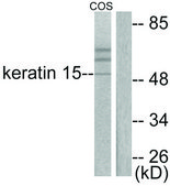 Anti-Keratin 15 antibody produced in rabbit affinity isolated antibody