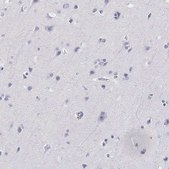 Anti-AKR1B1 antibody produced in rabbit Prestige Antibodies&#174; Powered by Atlas Antibodies, affinity isolated antibody
