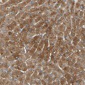 Anti-LDLR antibody produced in rabbit Ab1, affinity isolated antibody, buffered aqueous glycerol solution