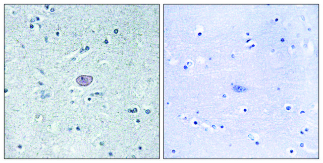 Anti-VEGFR2 antibody produced in rabbit affinity isolated antibody