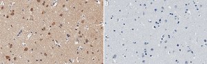 Anti-ROCK2 Antibody, clone 1B20 ZooMAb&#174; Rabbit Monoclonal recombinant, expressed in HEK 293 cells