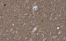Anti-&#946;-Tubulin III Antibody, clone 5H16, ZooMAb&#174; Rabbit Monoclonal recombinant, expressed in HEK 293 cells