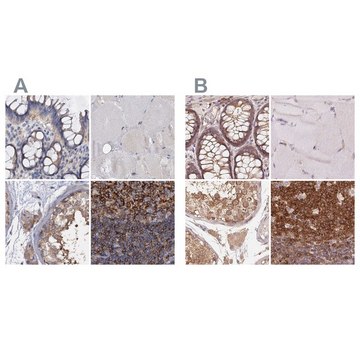 Anti-ANKRD13A antibody produced in rabbit Prestige Antibodies&#174; Powered by Atlas Antibodies, affinity isolated antibody, buffered aqueous glycerol solution