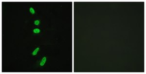 Anti-SF1, N-Terminal antibody produced in rabbit affinity isolated antibody