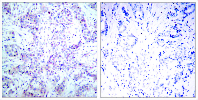 Anti-RELA (Ab-536) antibody produced in rabbit affinity isolated antibody
