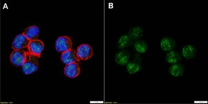 Anti-cIAP2/BIRC3 Antibody, clone 1N23 ZooMAb&#174; Rabbit Monoclonal recombinant, expressed in HEK 293 cells