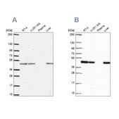 Anti-NDUFS2 antibody produced in rabbit Prestige Antibodies&#174; Powered by Atlas Antibodies, affinity isolated antibody, buffered aqueous glycerol solution