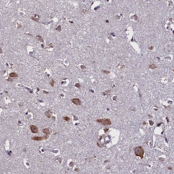 Anti-KCNE5 antibody produced in rabbit Prestige Antibodies&#174; Powered by Atlas Antibodies, affinity isolated antibody, buffered aqueous glycerol solution