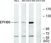 Anti-EPHB6 antibody produced in rabbit affinity isolated antibody