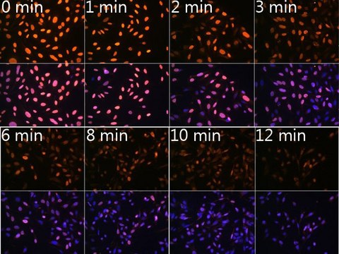 Anti-N6-methyladenosine / m6A antibody produced in rabbit