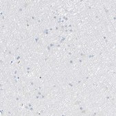 Anti-PRSS23 antibody produced in rabbit Prestige Antibodies&#174; Powered by Atlas Antibodies, affinity isolated antibody, buffered aqueous glycerol solution