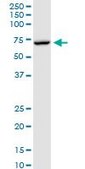 Anti-MTM1 antibody produced in rabbit purified immunoglobulin, buffered aqueous solution