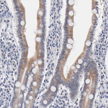 Anti-AADAC antibody produced in rabbit Prestige Antibodies&#174; Powered by Atlas Antibodies, affinity isolated antibody, buffered aqueous glycerol solution