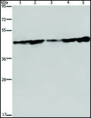 Anti-CERS4 antibody produced in rabbit affinity isolated antibody