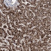 Anti-EHHADH antibody produced in rabbit Prestige Antibodies&#174; Powered by Atlas Antibodies, affinity isolated antibody, buffered aqueous glycerol solution