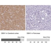 Anti-DBN1 antibody produced in rabbit Prestige Antibodies&#174; Powered by Atlas Antibodies, affinity isolated antibody, buffered aqueous glycerol solution
