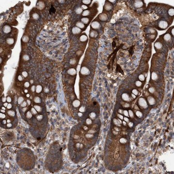 Anti-GGT6 antibody produced in rabbit Prestige Antibodies&#174; Powered by Atlas Antibodies, affinity isolated antibody, buffered aqueous glycerol solution