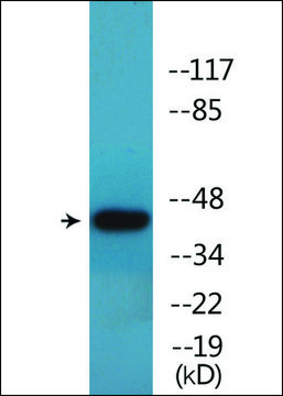 Anti-phospho-p53 (pSer46) antibody produced in rabbit affinity isolated antibody