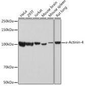Anti-&#945;-Actinin-4 Antibody, clone 5Y3R6, Rabbit Monoclonal