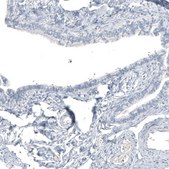Monoclonal Anti-HMOX1 antibody produced in mouse Prestige Antibodies&#174; Powered by Atlas Antibodies, clone CL11661, purified immunoglobulin, buffered aqueous glycerol solution
