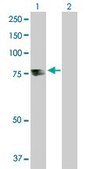 Anti-TDP1 antibody produced in rabbit purified immunoglobulin, buffered aqueous solution