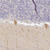 Anti-KCNH1 antibody produced in rabbit Prestige Antibodies&#174; Powered by Atlas Antibodies, affinity isolated antibody, buffered aqueous glycerol solution