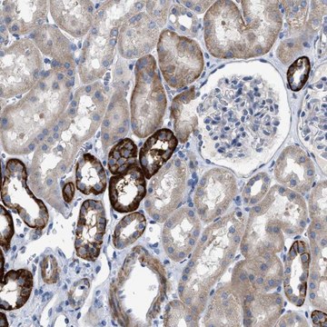 Anti-DHX58 antibody produced in rabbit Prestige Antibodies&#174; Powered by Atlas Antibodies, affinity isolated antibody, buffered aqueous glycerol solution, Ab1