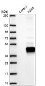 Anti-ADH5 antibody produced in rabbit Prestige Antibodies&#174; Powered by Atlas Antibodies, affinity isolated antibody, buffered aqueous glycerol solution