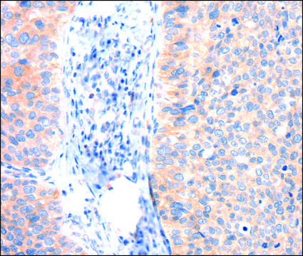 Anti-ANK3 antibody produced in rabbit affinity isolated antibody