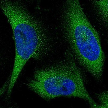 Anti-KLHL28 antibody produced in rabbit Prestige Antibodies&#174; Powered by Atlas Antibodies, affinity isolated antibody, buffered aqueous glycerol solution