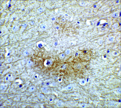 Anti-GLS2 antibody produced in rabbit affinity isolated antibody