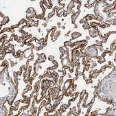 Anti-CD55 antibody produced in rabbit Prestige Antibodies&#174; Powered by Atlas Antibodies, affinity isolated antibody, buffered aqueous glycerol solution