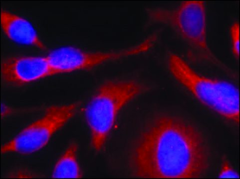 Anti-phospho-PRKD1 (pSer738) antibody produced in rabbit affinity isolated antibody
