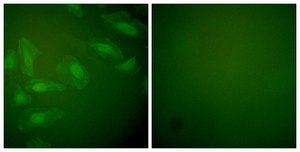 Anti-DJ-1 antibody produced in rabbit affinity isolated antibody