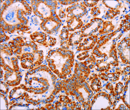 Anti-ADAMTS17 antibody produced in rabbit affinity isolated antibody