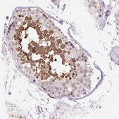 Anti-HSPA1A antibody produced in rabbit Prestige Antibodies&#174; Powered by Atlas Antibodies, affinity isolated antibody, buffered aqueous glycerol solution