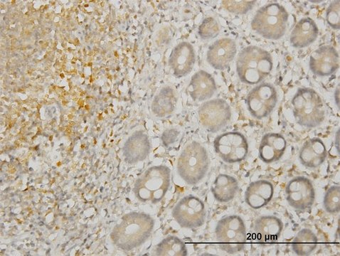 Monoclonal Anti-LIMK1, (C-terminal) antibody produced in mouse clone 1B2, purified immunoglobulin, buffered aqueous solution