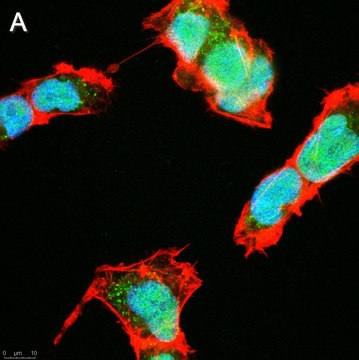 Anti-SOX-11 Antibody, clone 1F16 ZooMAb&#174; Rabbit Monoclonal recombinant, expressed in HEK 293 cells