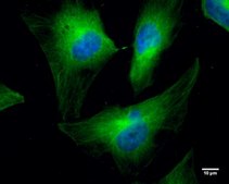 Monoclonal Anti-Cofilin 1 antibody produced in mouse clone GT567, affinity isolated antibody