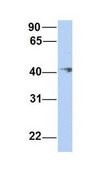 Anti-ERLIN1 antibody produced in rabbit affinity isolated antibody