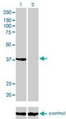 Monoclonal Anti-ANXA2 antibody produced in mouse clone 3E8-B6, purified immunoglobulin, buffered aqueous solution