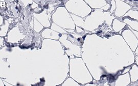 Anti-Perilipin-1 Antibody, clone 1G23 ZooMAb&#174; Rabbit Monoclonal recombinant, expressed in HEK 293 cells