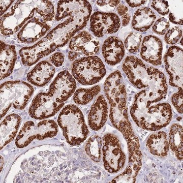 Anti-CNOT8 antibody produced in rabbit Prestige Antibodies&#174; Powered by Atlas Antibodies, affinity isolated antibody, buffered aqueous glycerol solution