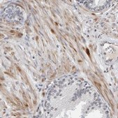 Anti-TEFM antibody produced in rabbit Prestige Antibodies&#174; Powered by Atlas Antibodies, affinity isolated antibody, buffered aqueous glycerol solution
