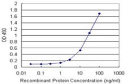 Monoclonal Anti-FTL antibody produced in mouse clone 4G10, purified immunoglobulin, buffered aqueous solution