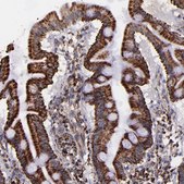Anti-IDH3G antibody produced in rabbit Ab2, Prestige Antibodies&#174; Powered by Atlas Antibodies, affinity isolated antibody, buffered aqueous glycerol solution