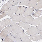 Anti-DIABLO antibody produced in rabbit affinity isolated antibody, buffered aqueous glycerol solution